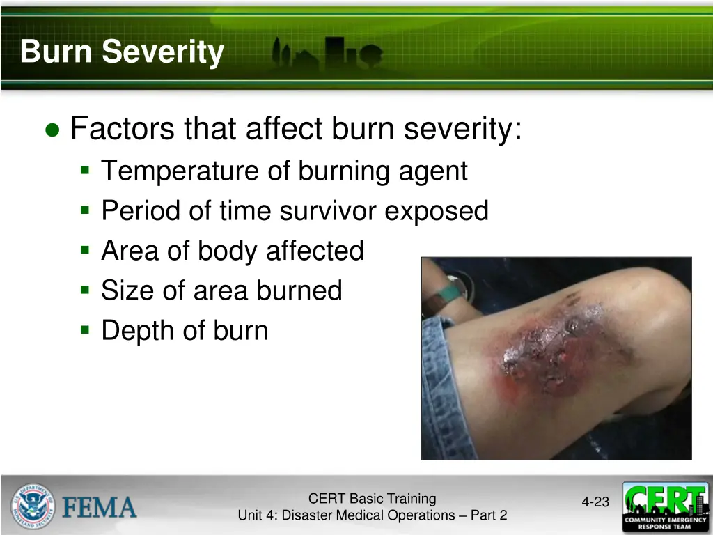 burn severity