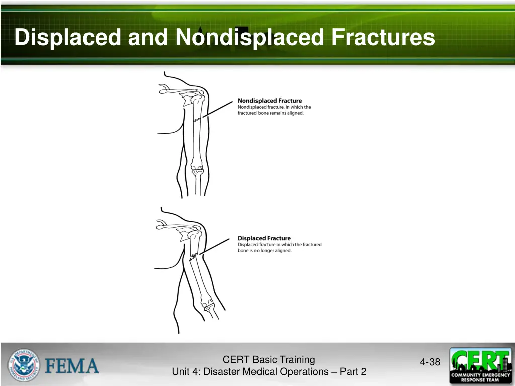 displaced and nondisplaced fractures