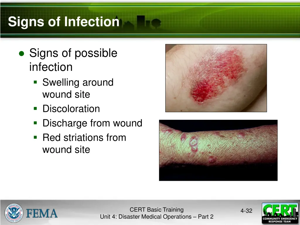 signs of infection