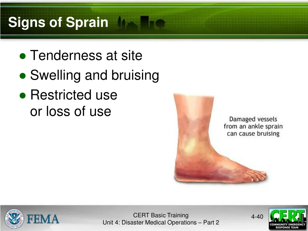 signs of sprain