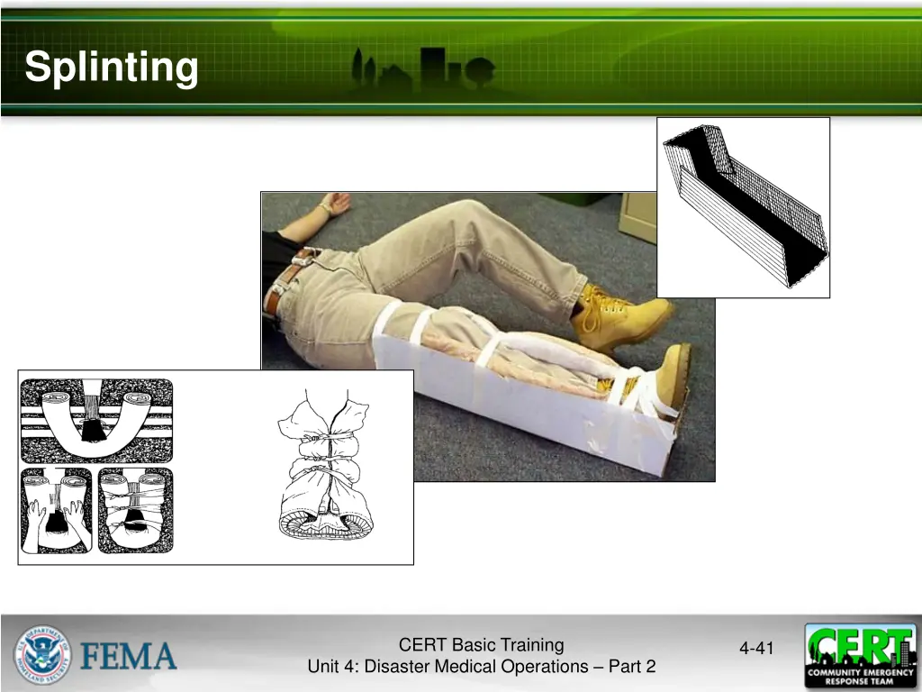 splinting