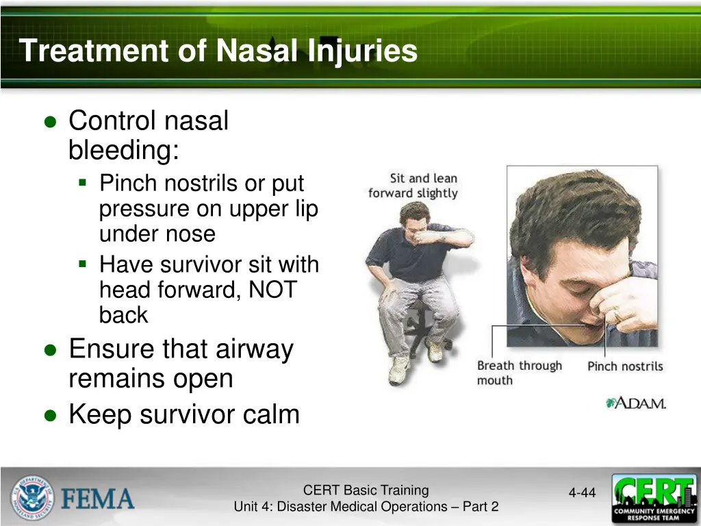 treatment of nasal injuries