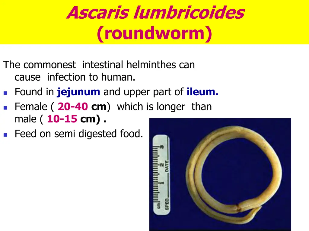 ascaris lumbricoides roundworm 1