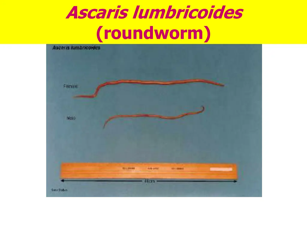 ascaris lumbricoides roundworm