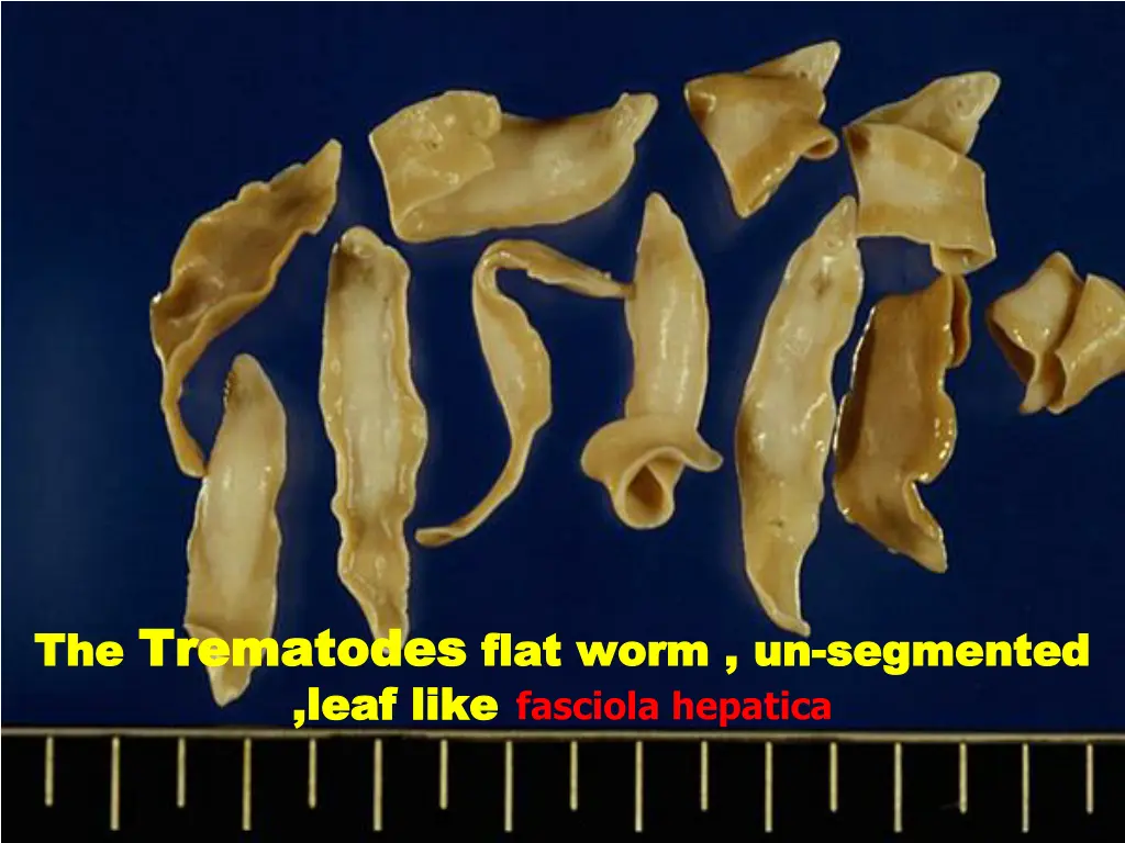 the trematodes trematodes flat worm un leaf like