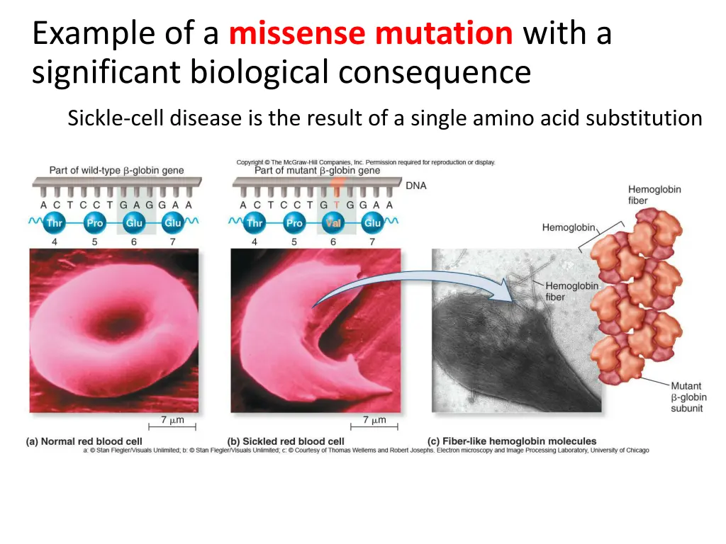 example of a missense mutation with a significant