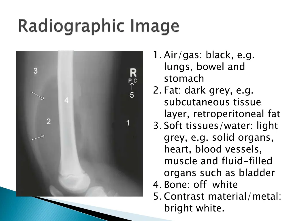 1 air gas black e g lungs bowel and stomach