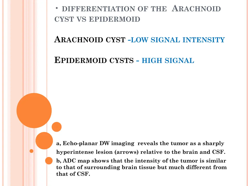 differentiation of the a rachnoid cyst