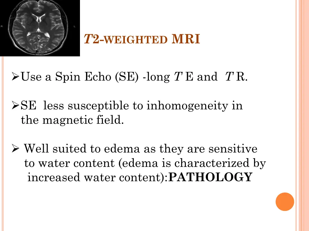 t 2 weighted mri