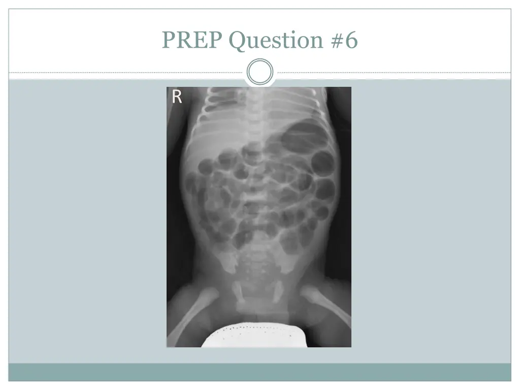 prep question 6 1