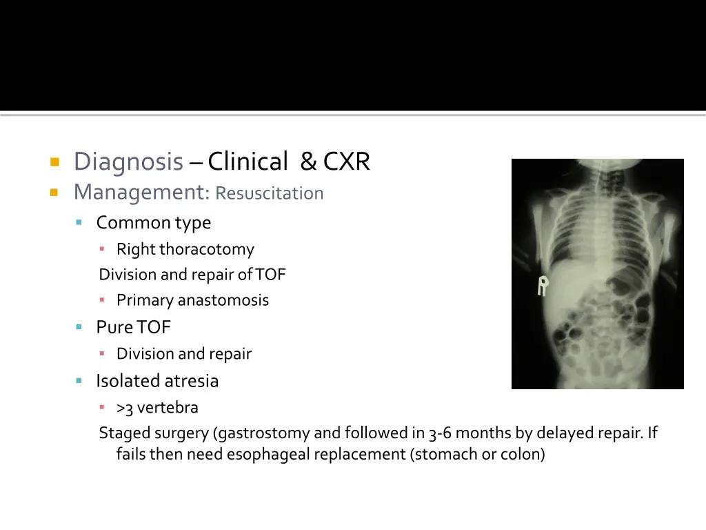 diagnosis clinical cxr management resuscitation