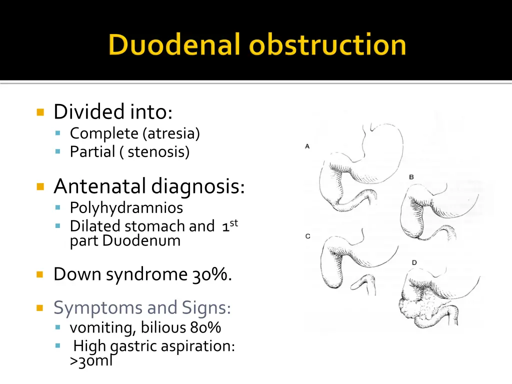 divided into complete atresia partial stenosis