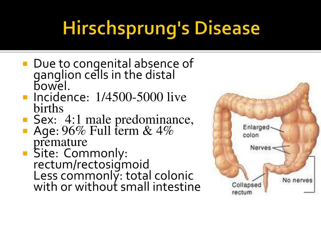 due to congenital absence of ganglion cells