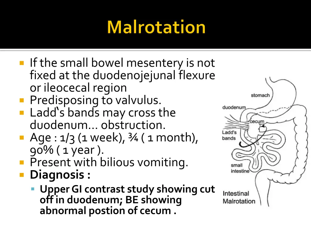 if the small bowel mesentery is not fixed