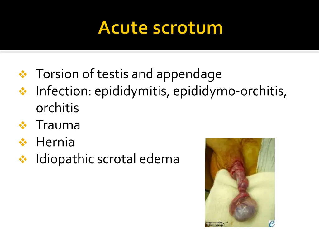 torsion of testis and appendage infection