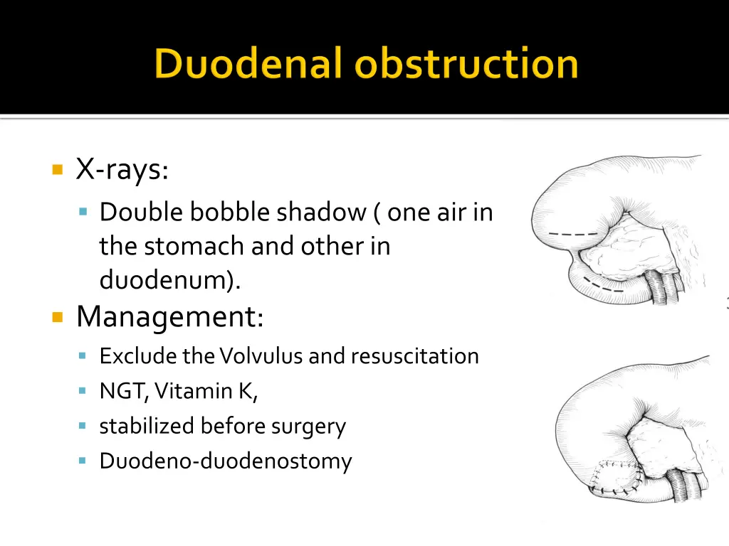 x rays double bobble shadow