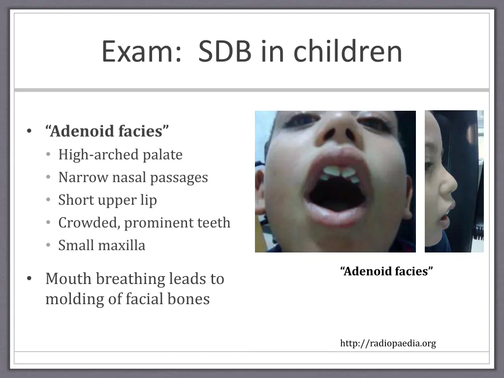 exam sdb in children