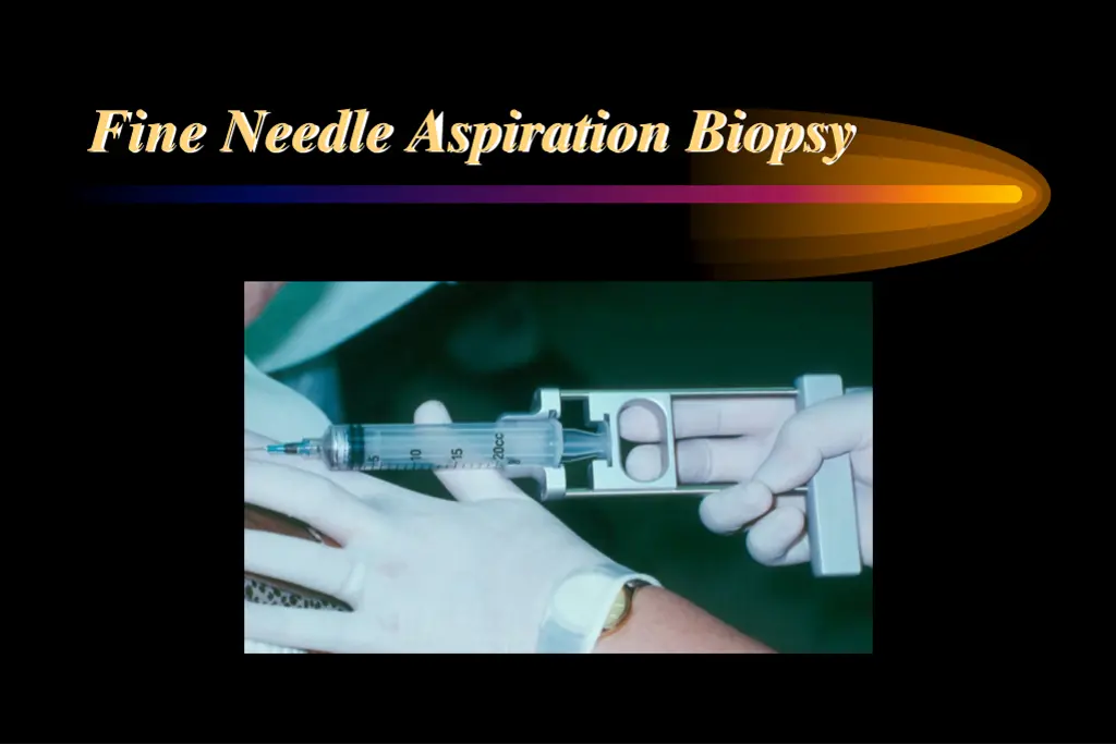 fine needle aspiration biopsy 2