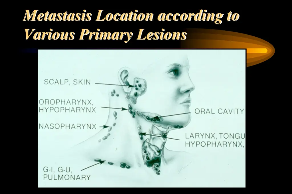 metastasis location according to various primary