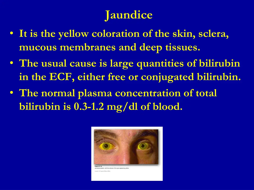 jaundice