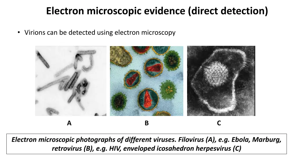 electron microscopic evidence direct detection