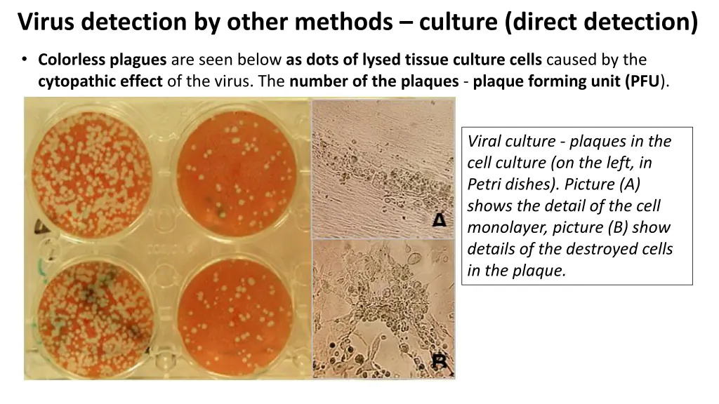 virus detection by other methods culture direct