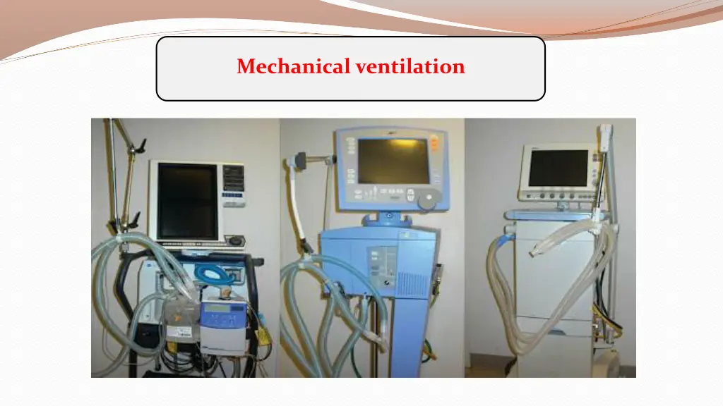 mechanical ventilation