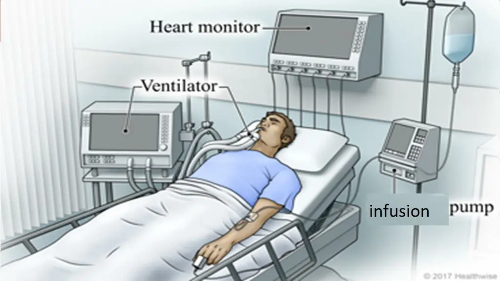 pump infusion