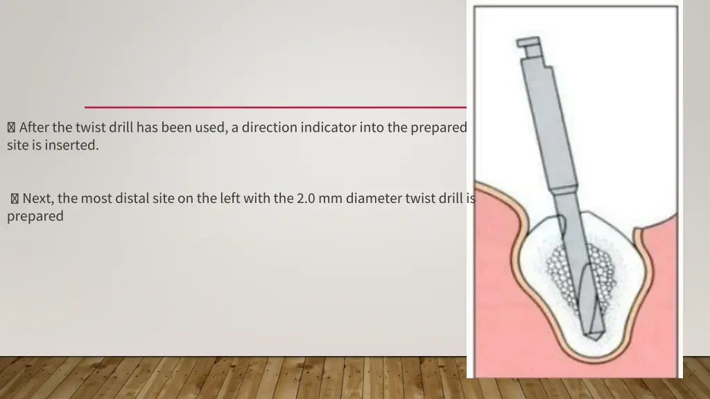 after the twist drill has been used a direction