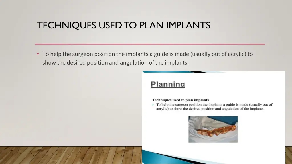 techniques used to plan implants 1