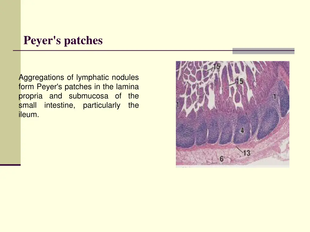 peyer s patches