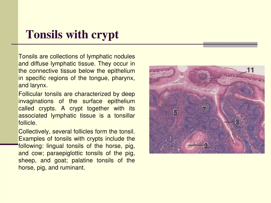 tonsils with crypt