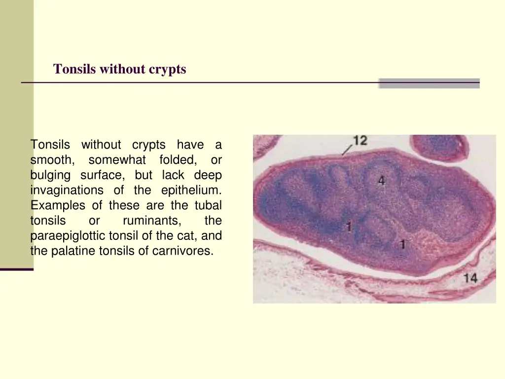 tonsils without crypts