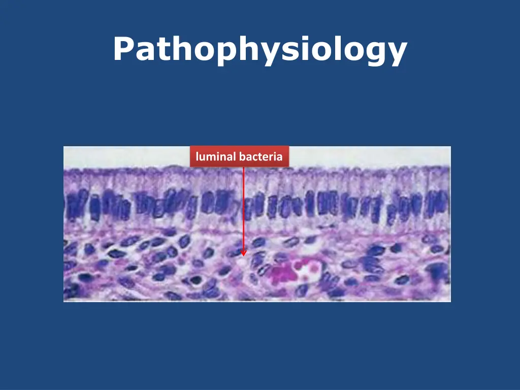 pathophysiology