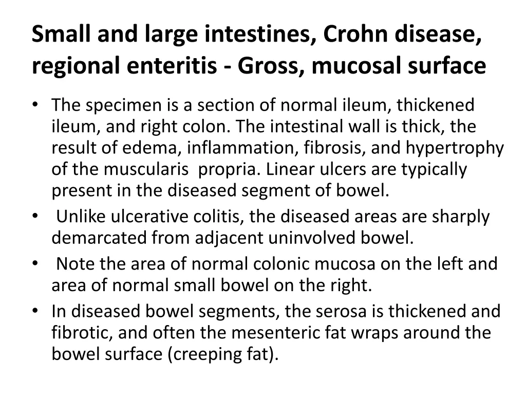 small and large intestines crohn disease regional