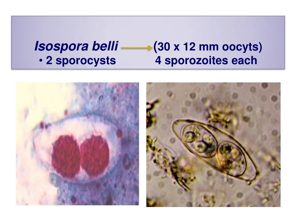 isospora belli 2 sporocysts 4 sporozoites each