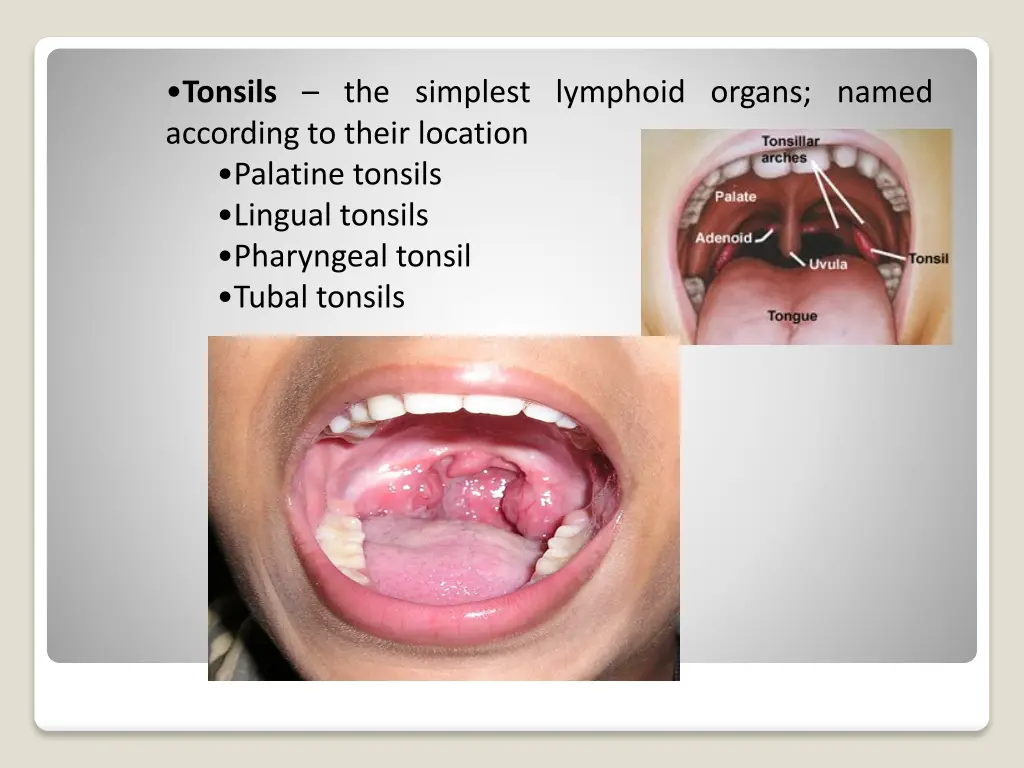 tonsils the simplest lymphoid organs named