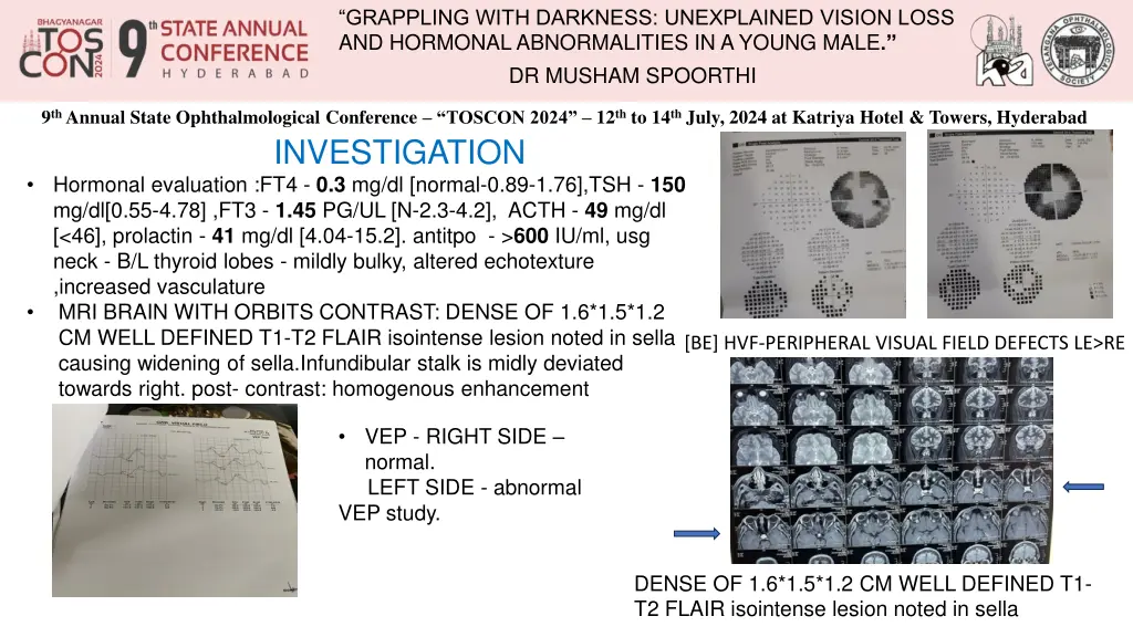 grappling with darkness unexplained vision loss 3