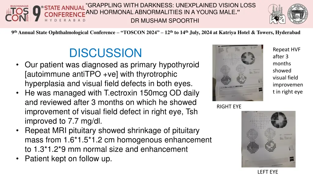 grappling with darkness unexplained vision loss 4