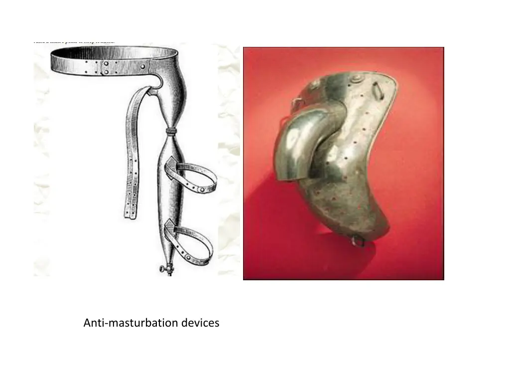 male anti masturbation device 1880 1920