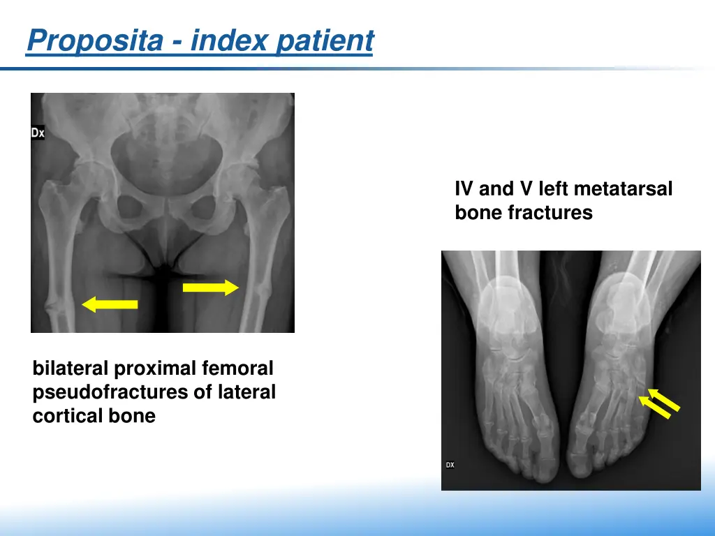 proposita index patient 3