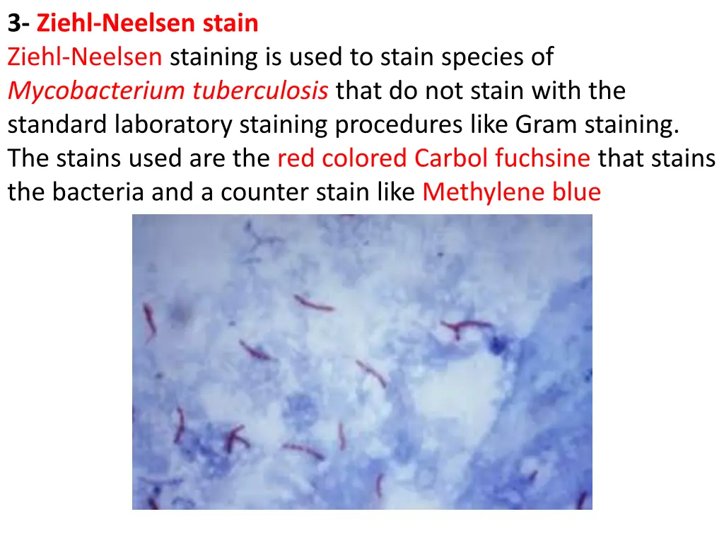 3 ziehl neelsen stain ziehl neelsen staining