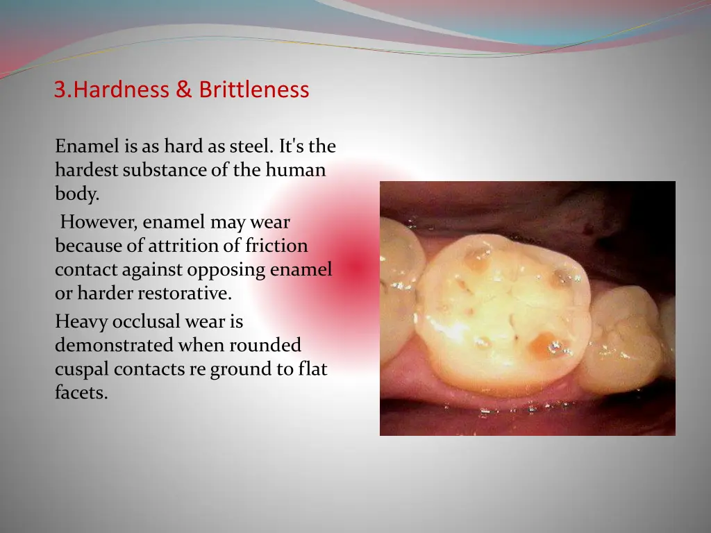 3 hardness brittleness