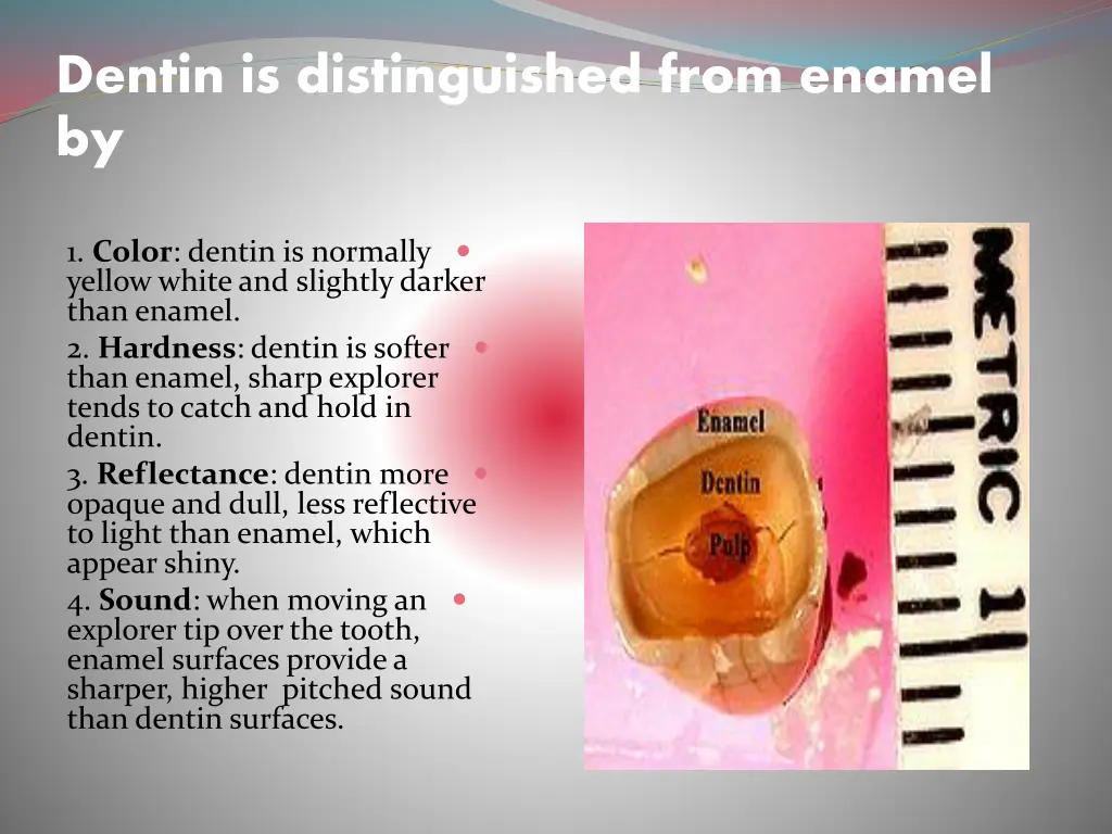 dentin is distinguished from enamel by