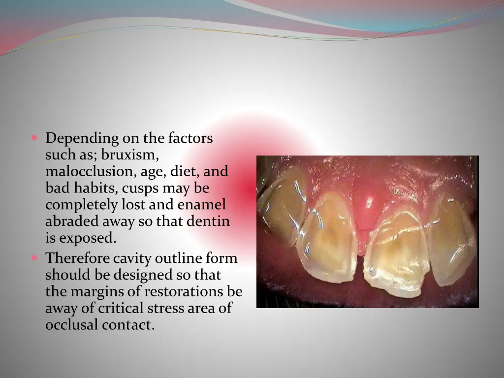 depending on the factors such as bruxism