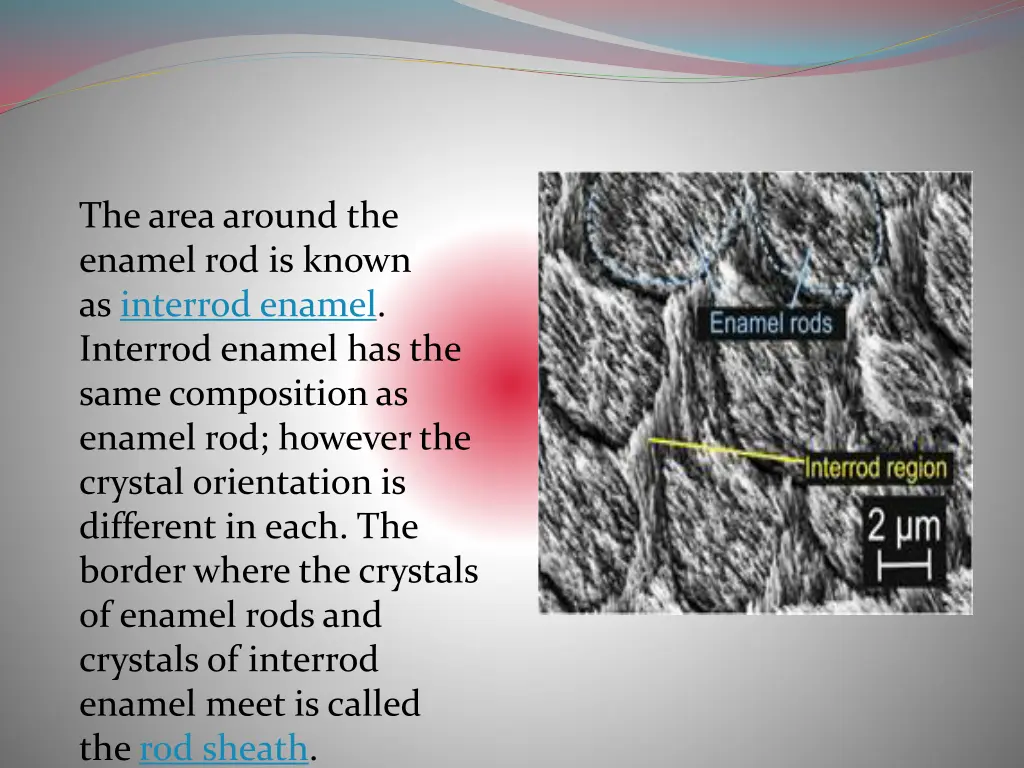 the area around the enamel rod is known