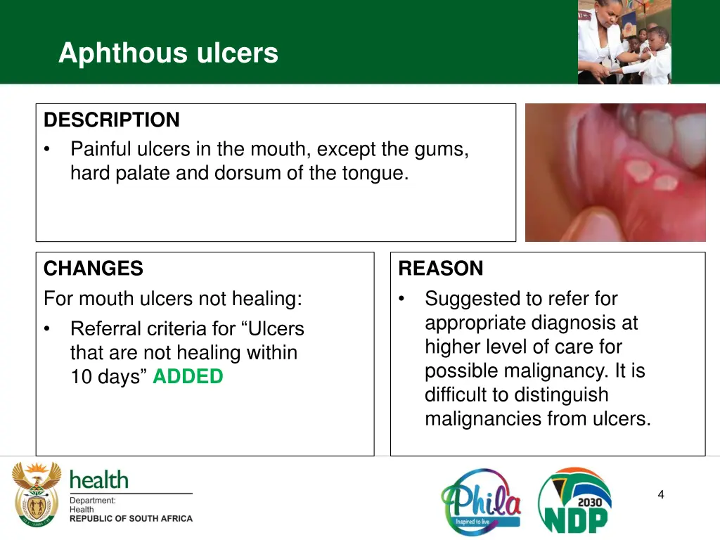 aphthous ulcers