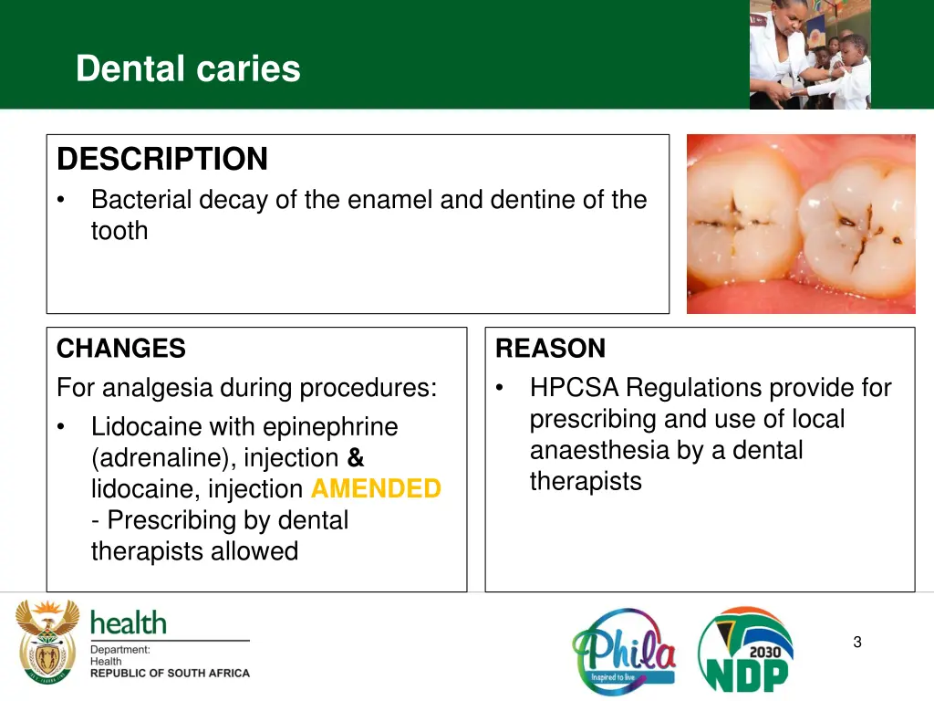 dental caries