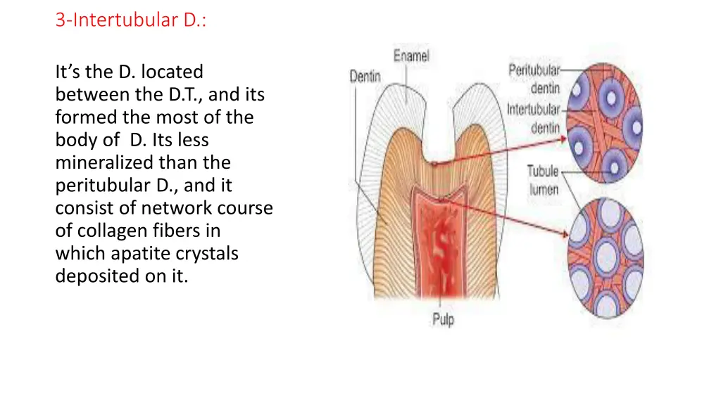 3 intertubular d