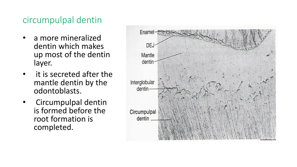 circumpulpal dentin